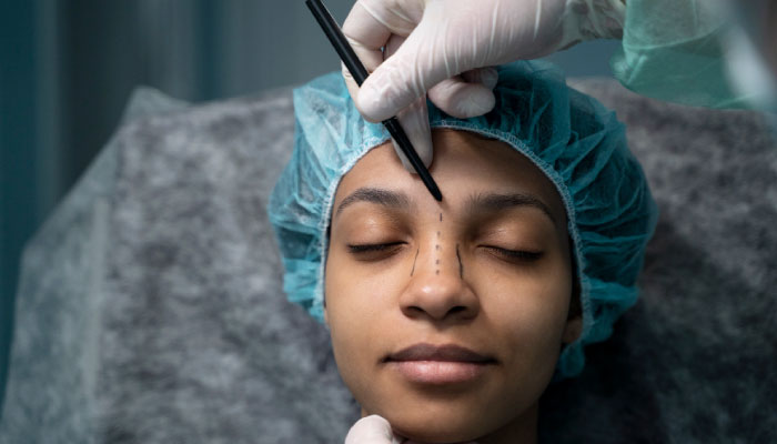 Rhinoplasty – Nose Reshaping Surgery