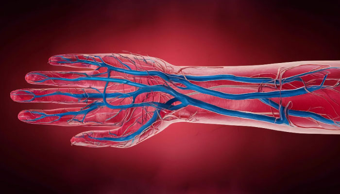 A-V Fistula Creation for Dialysis